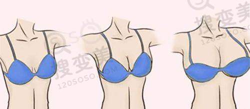 谢仕乔医生擅长项目