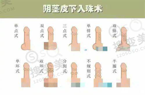 连园园院长擅长项目