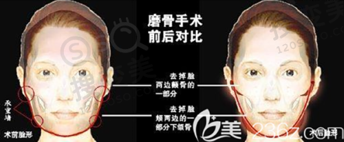 王占福医生价格表