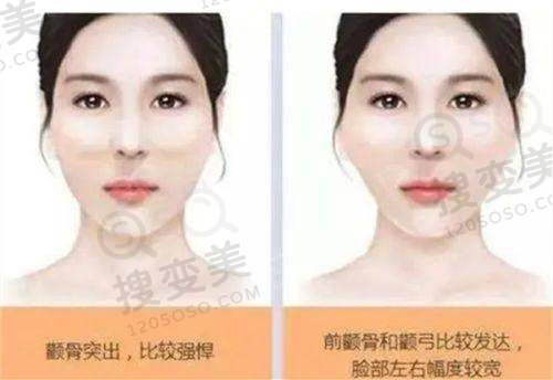 兴凯医生口碑评价及真人实例