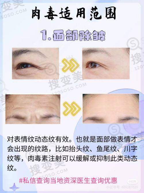 上海做私密整形哪家好?宏康医院私密科性价比之选