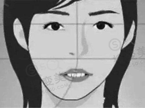 贵阳双眼皮修复更好医院之贵阳美贝尔医疗美容医院