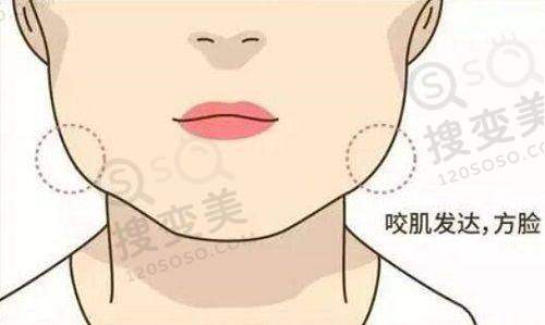 贵阳腹壁整形医院哪家好——利美康腹壁整形真实实例展示