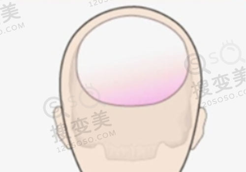 南京抽脂哪家医院好？——南京友谊整形医院