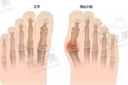 南京更好的整形医院是哪家——南京美伊成医疗美容诊所