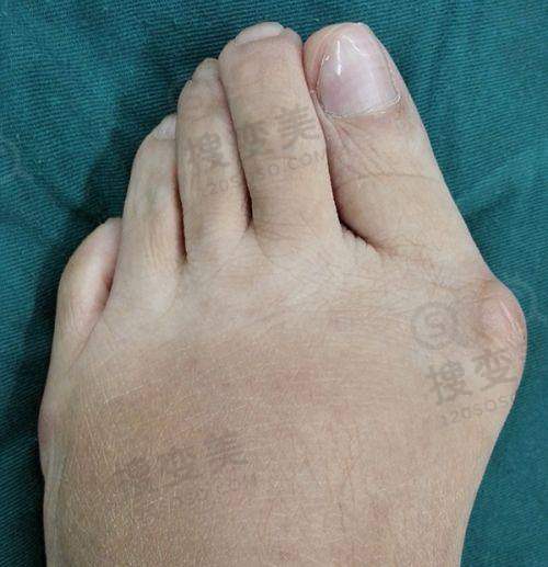 贵阳隆鼻更好的医生之杜良军 医生