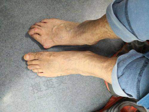 南京割双眼皮排名之总结与建议