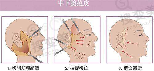 南京隆鼻最好的医生排名，沈正宇/黄名斗等技术优、风格多且价格透明 