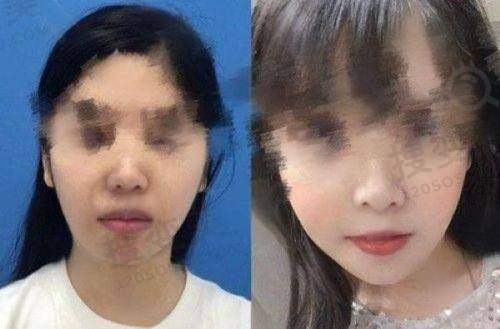长沙丰胸更好的医院排名之华韩医疗美容医院