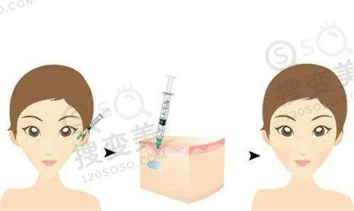 南京抽脂手术需要多少钱费用？多院多医生技术优收费明，口碑超赞 