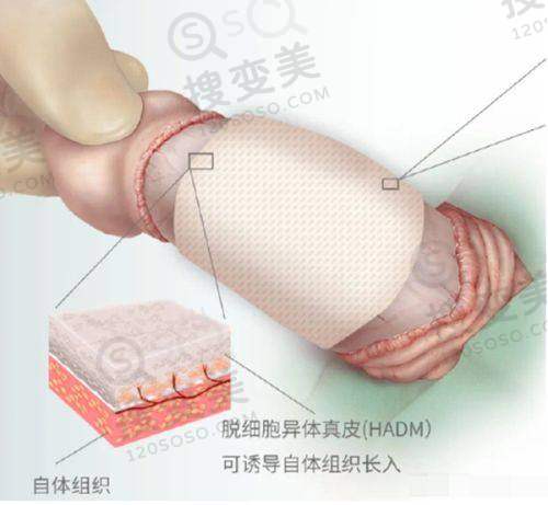 南京抽脂哪家医院好？——南京连天美整形医院