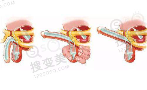 南京隆鼻去哪好：美贝尔医院的亮点