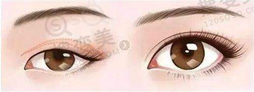 南京做私密整形哪家好——家和医院的特色