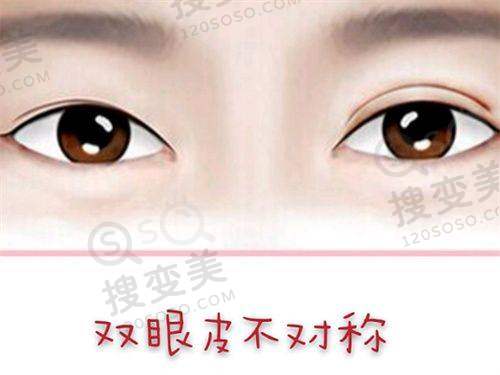 2025南宁华美整形收费标准公布，丰胸隆鼻价格实惠，赵广生卢志刚技术优 