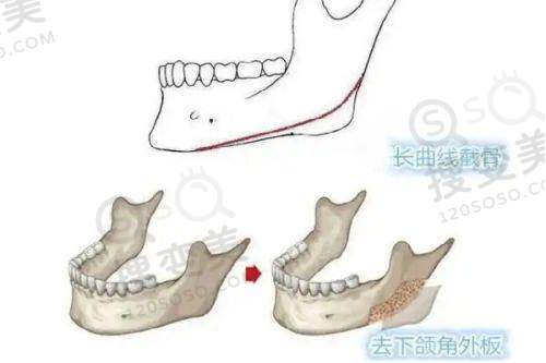 长沙美容整形医院哪家好——长沙艺星医学美容医院