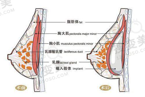 南京抽脂哪家医院好？——南京艺星整形医院