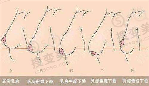 南京抽脂哪家医院好？——南京美莱整形医院