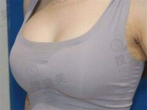 贵阳双眼皮哪家医院好之其他医院推荐