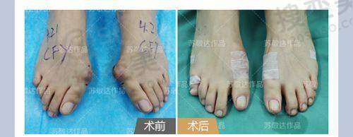 南宁哪里能做异物取出手术——专科医院篇