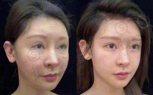贵阳双眼皮做得好的医生所在医院优势对比