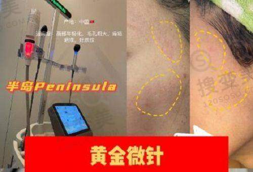 贵阳隆鼻医院排名第一之患者口碑评价分析
