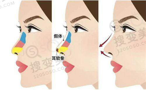 贵阳整形医院排行榜之其他特色医院