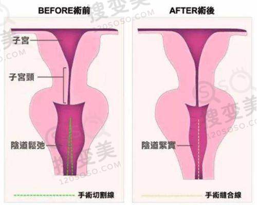 长沙美容整形医院哪家好——长沙协雅医疗美容医院