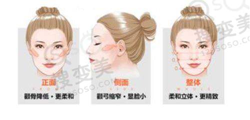 贵阳双眼皮哪家医院好之贵州利美康整形外科医院