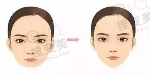 南京抽脂医院怎么选？鼓楼/美贝尔/华美等费用透明，技术靠谱 