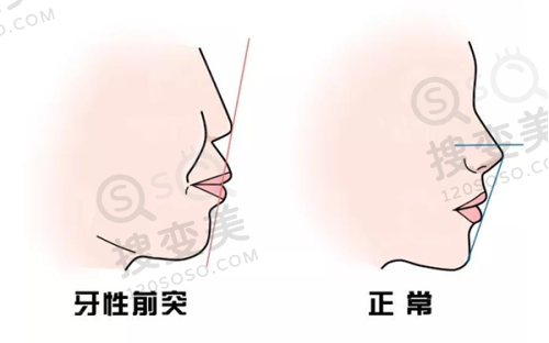 南京抽脂更好的医院之南京艺星