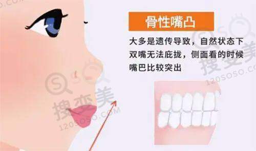 南京比较好的双眼皮修复医生之金东勋