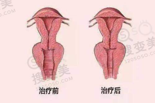 合肥整形美容医院排名前十位，韩美/华美/壹加壹口碑好技术优值得选 