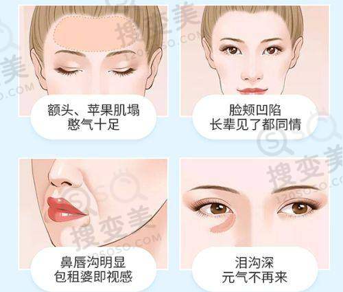 合肥双眼皮修复周瑜做的好吗?手术技术优势分析