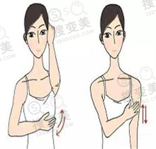 双眼皮南京哪家整形院比较好之南京华美整形医院