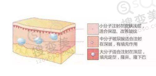 南京做双眼皮大概什么价格——南京艺星