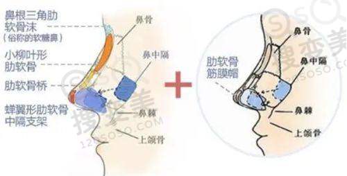 南京隆鼻医院排名前十之南京美贝尔与陈刚医生