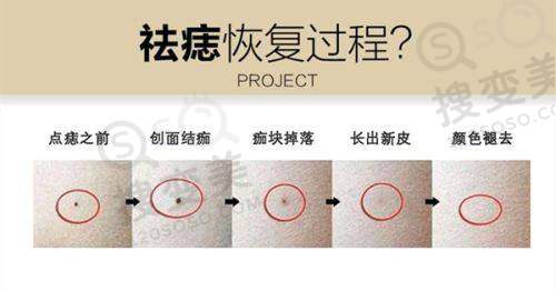 贵阳整形医院排名第一之与其他医院对比