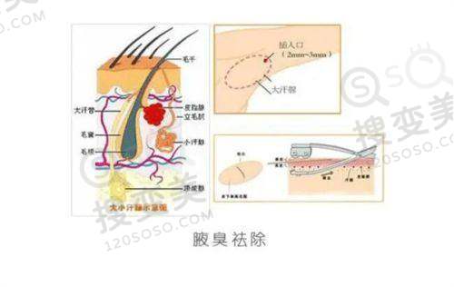 贵阳隆鼻哪家医院好之美莱整形医院