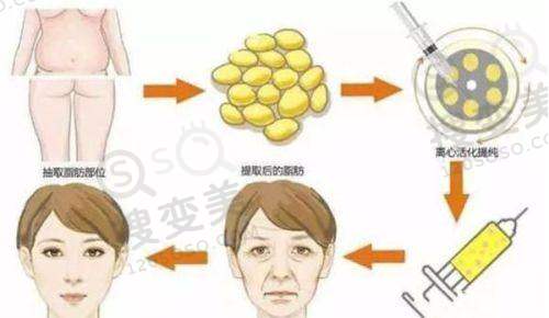 长沙哪家医美做的更好?——长沙雅美医疗美容医院