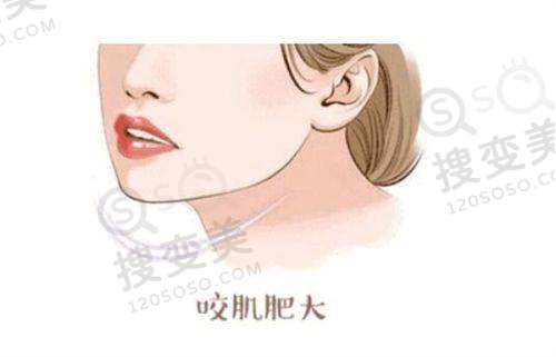 合肥整形美容医院排名前十位之恒美整形医院