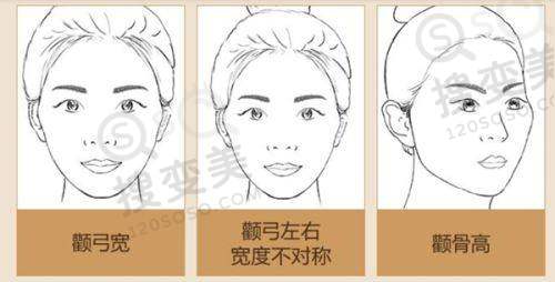 南京抽脂手术需要多少钱费用——选择医院和医生的建议