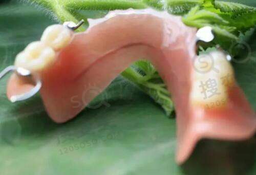 假体三件套植入后感受心得之术后结果