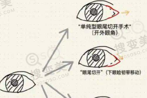 2025成都去疤痕的正规医院排名之其他医院