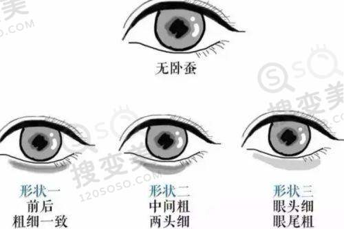 24小时植发在线预约挂号极速通道：北京/上海/广州三城0元毛囊检测，植发效果优口碑好
