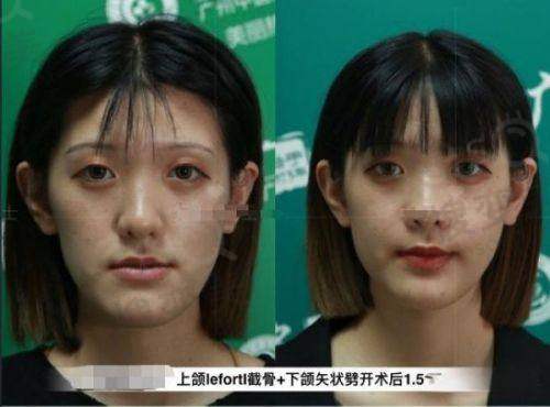 北京：0元毛囊检测+优质植发体验