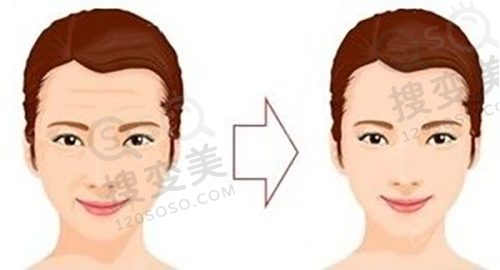 70岁以上老人免费种牙的资格条件之口腔条件要求