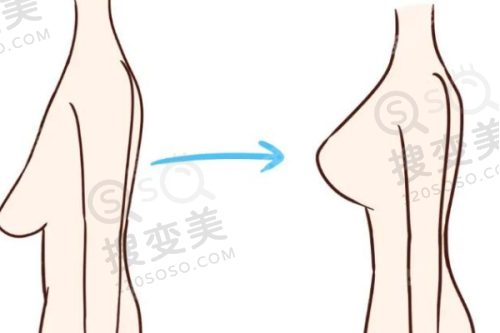 国内爱贝芙官网授权医院及爱贝芙注射认证医生名单都在这里了!——其他地区