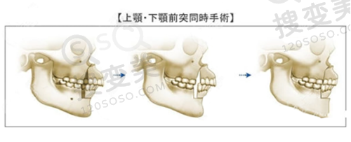 腋臭和狐臭有什么区别怎么辨别——成都圣之隅整形治疗优势