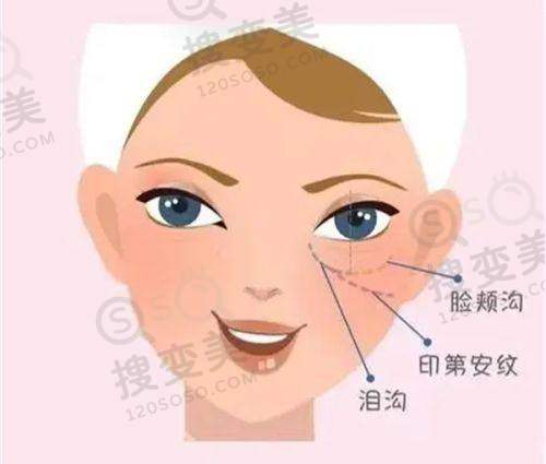 星趣控授权店一定是正版吗？——如何辨别授权店