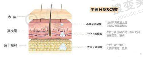 假体三件套植入后感受心得之手术过程